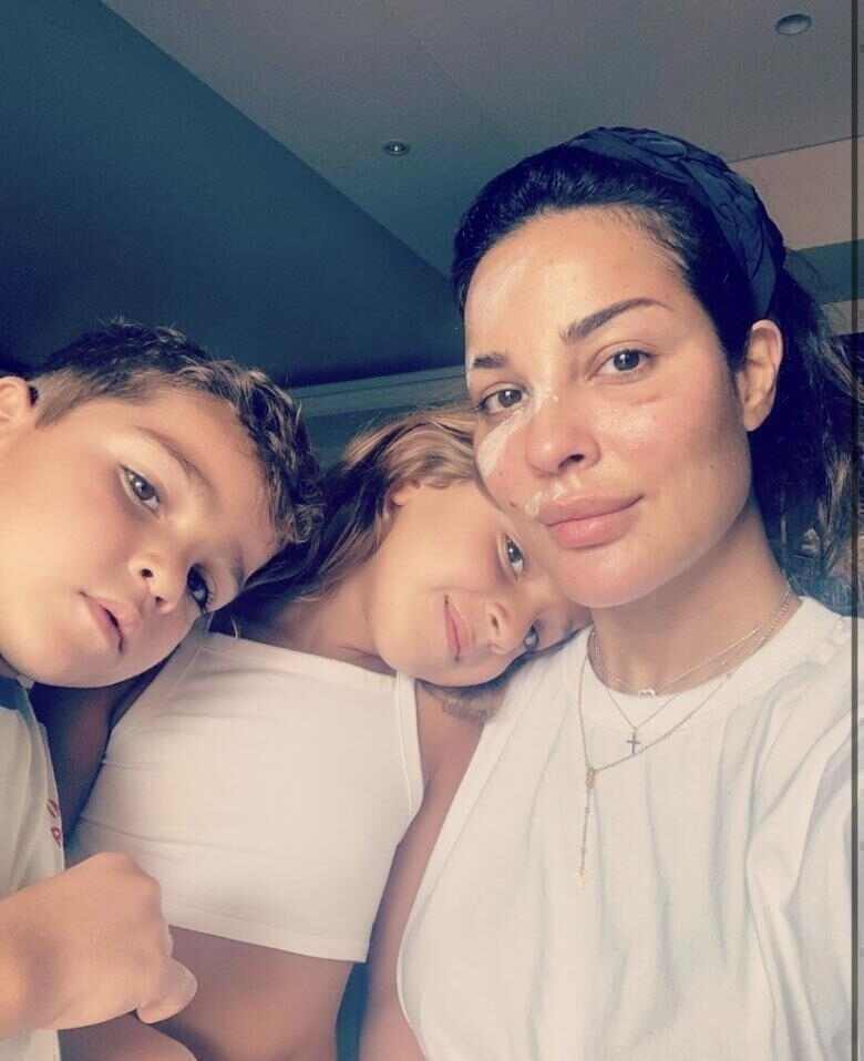 شاهد أول صورة لوجه ندين نجيم بعد إنفجار بيروت